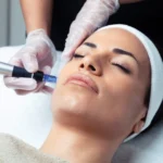 HydraFacial en clínica de medicina estética Zona 10, Guatemala