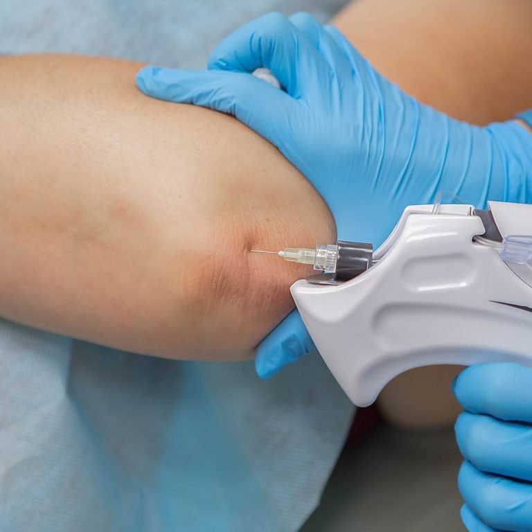 Ozonoterapia Guatemala